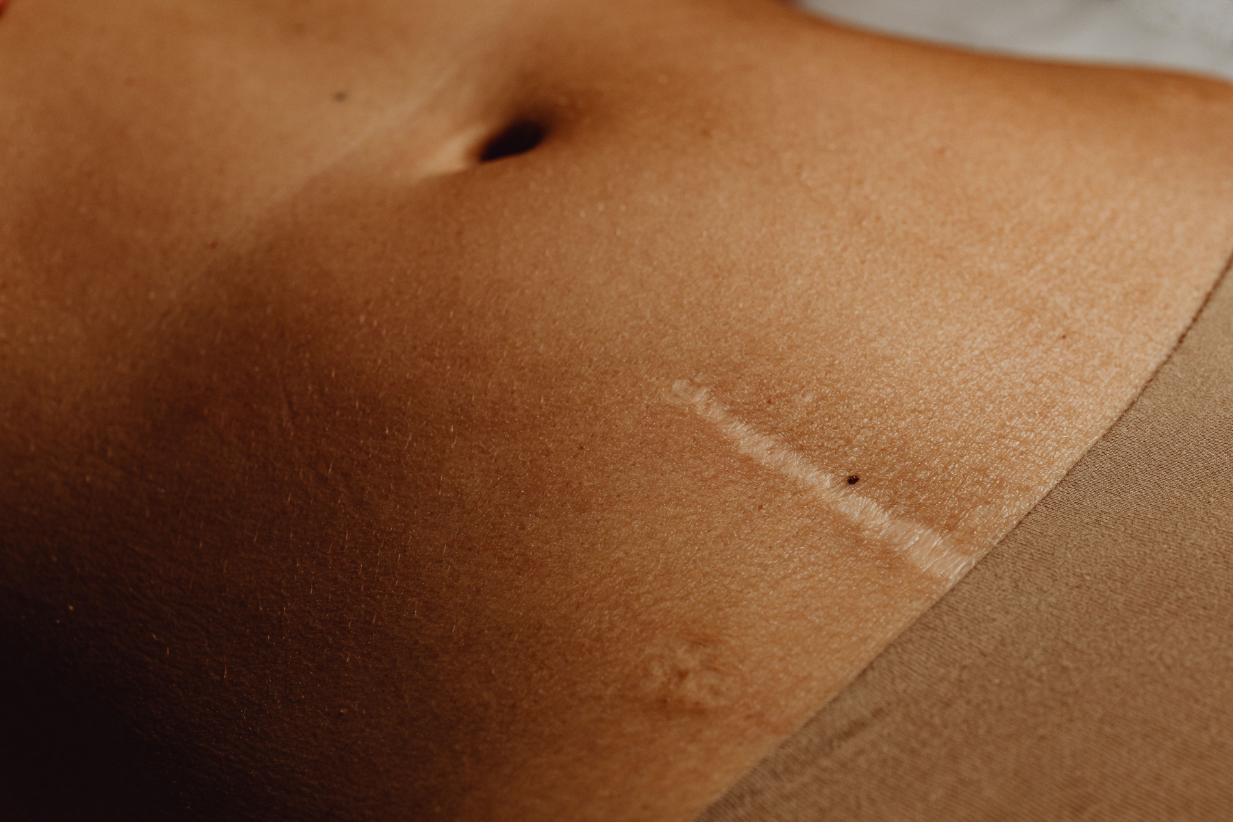 Viscerální fascie a děložní stahy: Jak napětí v břišní dutině mechanicky blokuje odtok krve