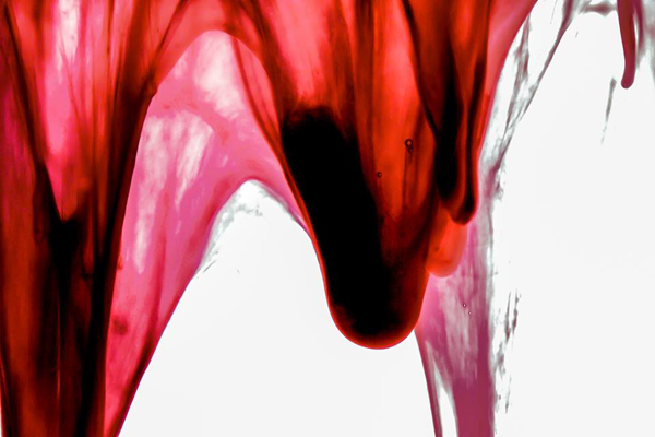 Beauty in Blood je abstraktní, feministický umělecký projekt Jen Lewis, ve kterém pracuje s krví s důrazem na její estetické kvality. 