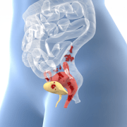 Endometrióza pod drobnohledem: Proč diagnóza trvá roky a jaké jsou možnosti úlevy?